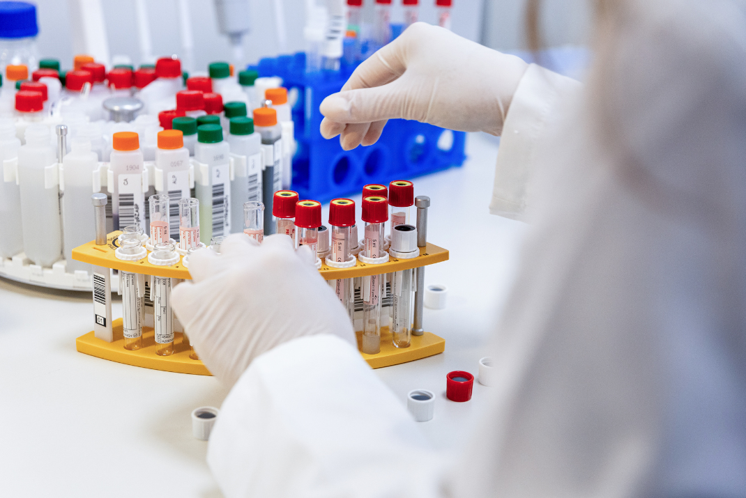 Different testing tubes for a Clinical Chemistry closed system by Diatron
