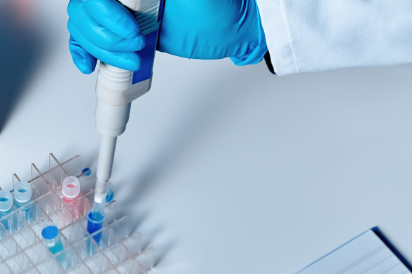Laboratorian inserting samples into the test tubes in a laboratory at STRATEC