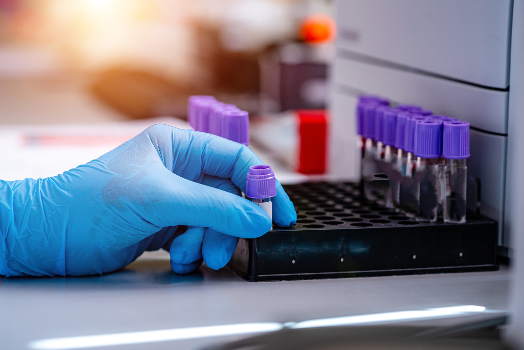 Laboratorian with blue safety gloves puts a testing tube into a tube rack