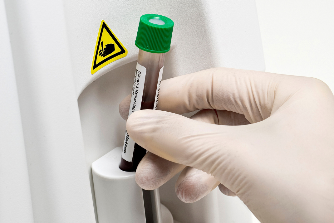 Test tube being put into a hematology CBC systems by Diatron