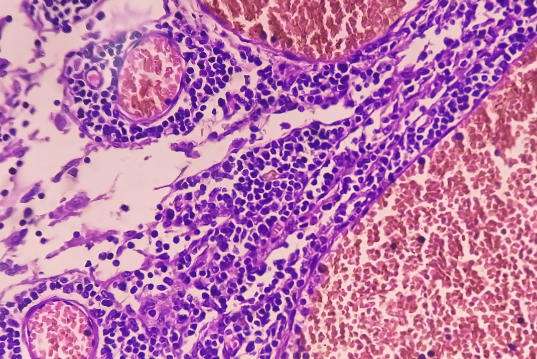 Close-up of a tissue under the microscope at STRATEC for tissue diagnostics